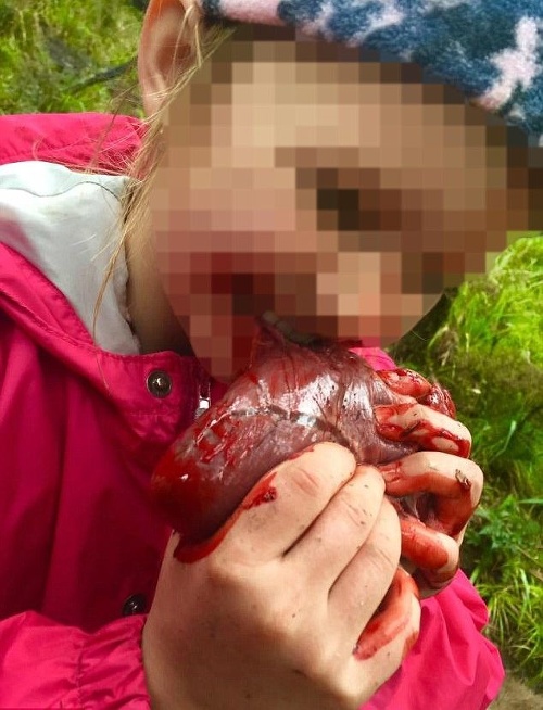 Dievčatko sa zahryzlo do srdca. Po rukách jej ešte stekala krv.