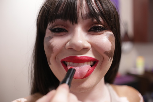 Tanesha Brown sa pre vitiligo od ostatných odlišuje na prvý pohľad.