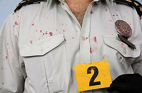 Policajt mal po napadnutí na uniforme množstvo krvavých škvŕn.
