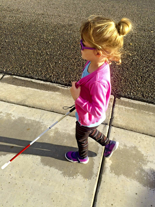 Dievčatko sa učí chodiť pomocou slepeckej palice.