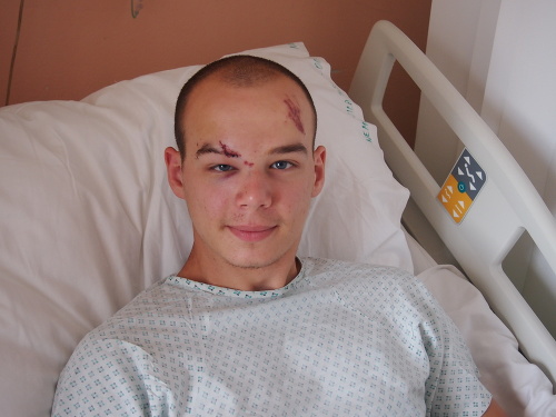 V nemocnici: Dávid (19)  už je z najhoršieho vonku.