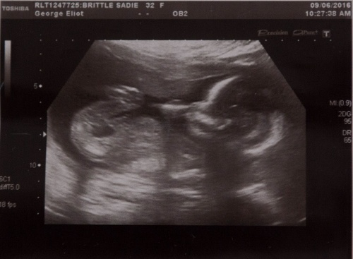 Saddie porodí chlapčeka v novembri.