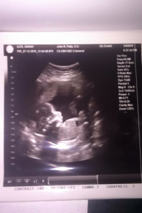 V januári Sarah zverejnila fotku z ultrazvuku.