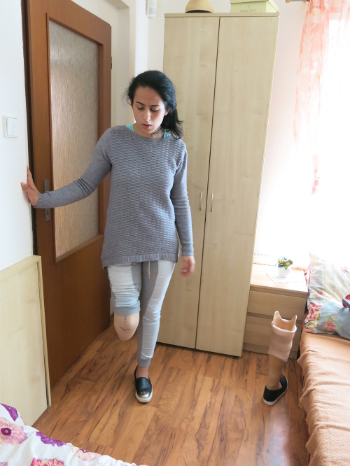 2016 - Mladé dievča je bez nohy a s protézou sa mu len ťažko chodí.
