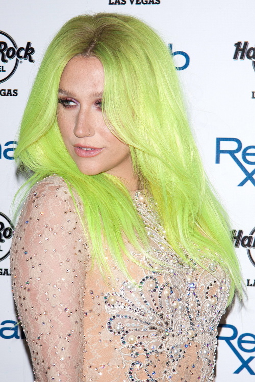 Kesha a jej neónové zeleno-žlté vlasy.