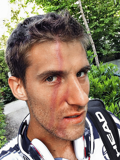 Pracovný úraz: Utrpel ho Martin Kližan v Paríži, kde sa hotuje na Roland Garros.