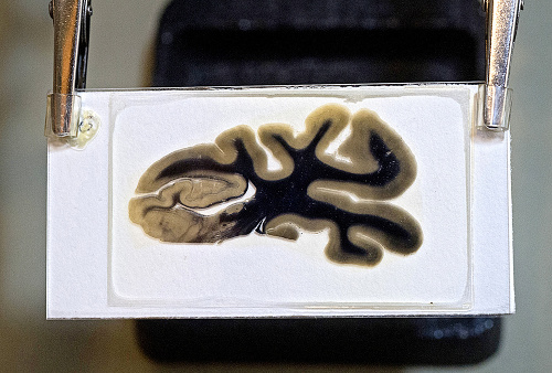 Vzorka Einsteinovho mozgu, ktorú patológ ukradol. 