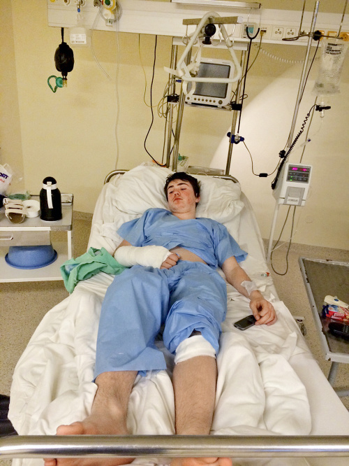 Teodor (15) po hrozivom páde skončil v nemocnici iba na niekoľko hodín, kým ho ošetrili.