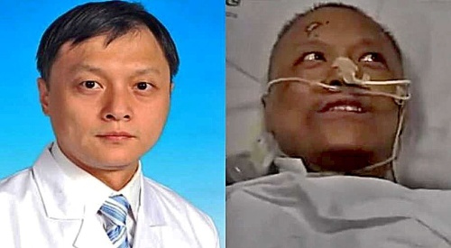 Dr. Ji Fan bol na mimotelovom obehu 39 dní.