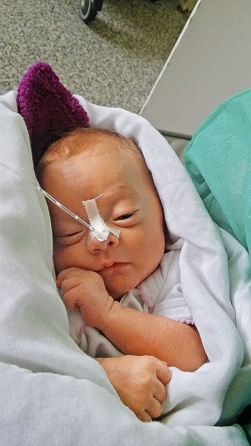 Glorinka sa narodila v 28. týždni tehotenstva a bola veľmi maličká.
