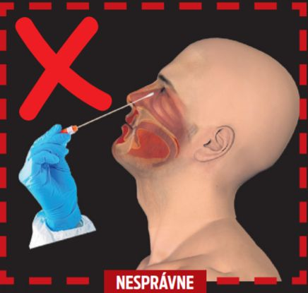 Pri zaklonení urobí zdravotník ster z hornej, užšej časti nosovej dutiny.