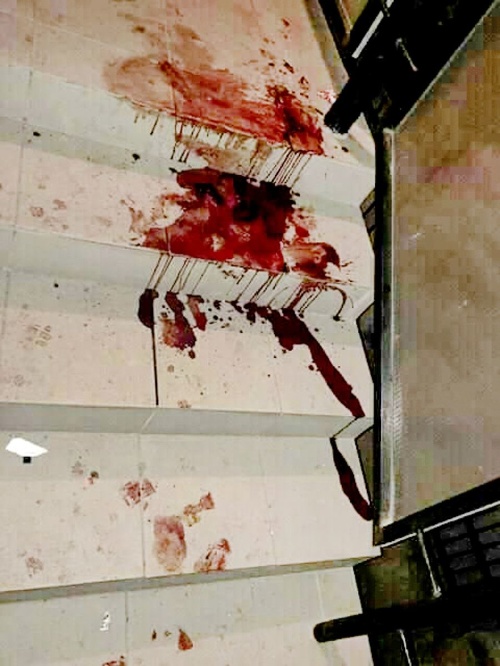 Po brutálnej bitke zostala na schodoch kaluž krvi.