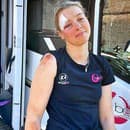 Nora Jenčušová preteky Strade Bianche nedokončila: Majsterka Slovenska skončila v krvi!