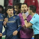 Šokujúci útok fanúšika na hráča Fiorentiny: Po bombe do tváre zostal celý krvavý!