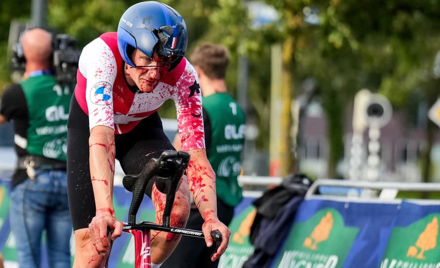 Otras mozgu, zlomenina ruky a lícnej kosti, k tomu množstvo odrenín. Švajčiarsky cyklista Stefan Küng (29) prišiel do cieľa ME v holandskom ...