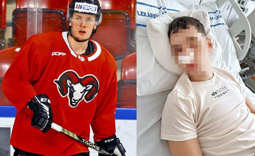 Slovenský hokejový obranca mal počas víkendu v podniku v Banskej Bystrici napadnúť svojho rovesníka, ktorému spôsobil vážne zranenia.