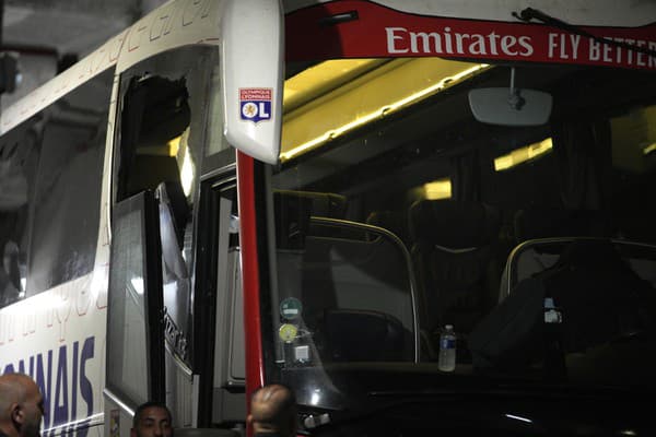 Na autobus futbalistov Lyonu zaútočili kameňmi a zranili trénera Fabia Grossa.