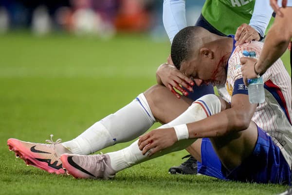 Kylian Mbappé skončil celý zakrvavený a jeho účasť na šampionáte bolo po zápase otázna.