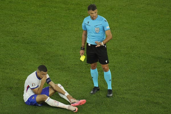 Kylian Mbappé skončil celý zakrvavený a jeho účasť na šampionáte bolo po zápase otázna.