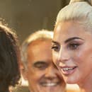 Lady Gaga patrí k speváckym ikonám súčasnosti.