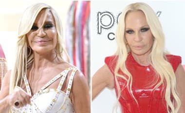 Donatella Versace rieši starnutie prehnanými plastikami: Keď ju uvidíte na fotkách z minulosti, padne vám sánka. ÚPLNÁ KOČKA!