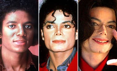 Šokujúca pitevná správa Michaela Jacksona: Spevák musel pred smrťou poriadne TRPIEŤ, takéto hrôzy našli na jeho tele
