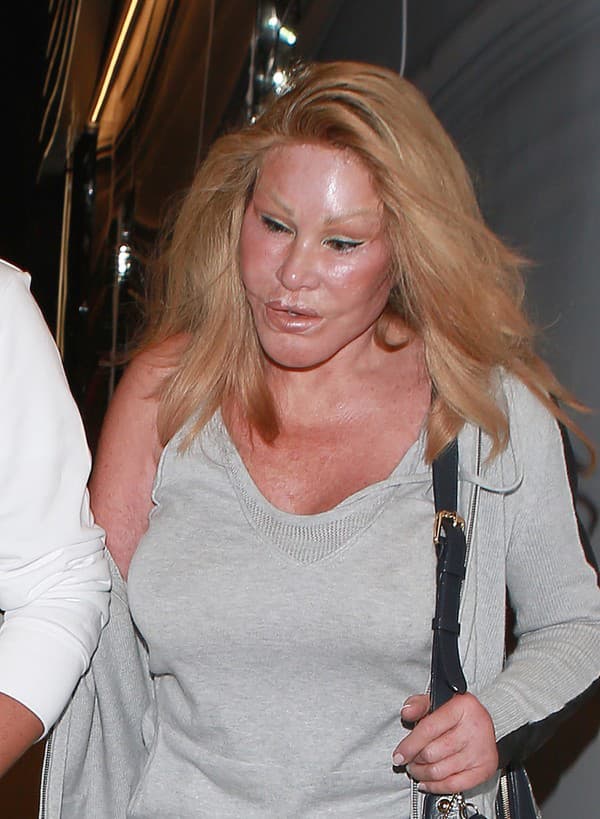 Jocelyn Wildenstein 